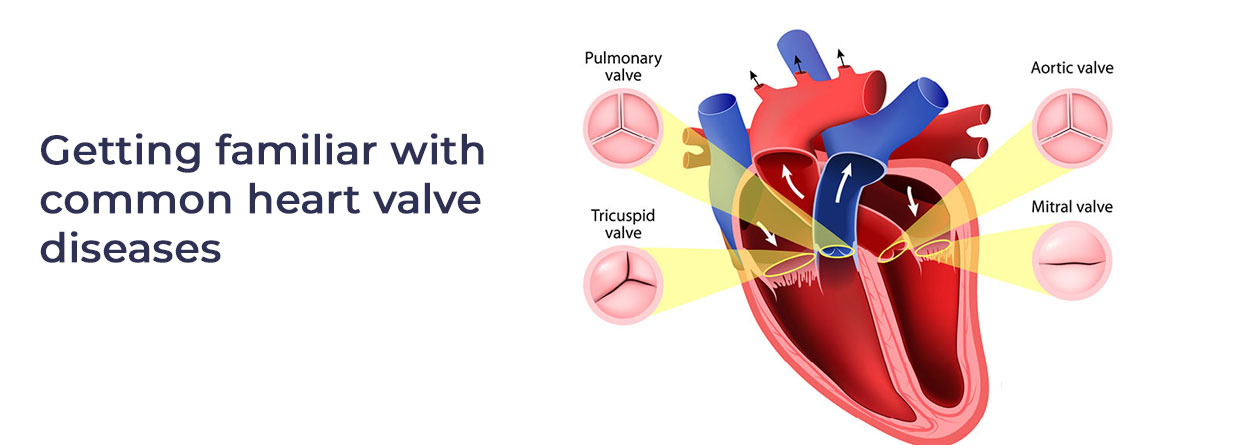Getting Familiar with Common Heart Valve Diseases